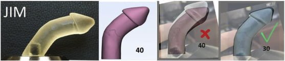 penisverkrümmung_ipp_induratio_penis_plastica